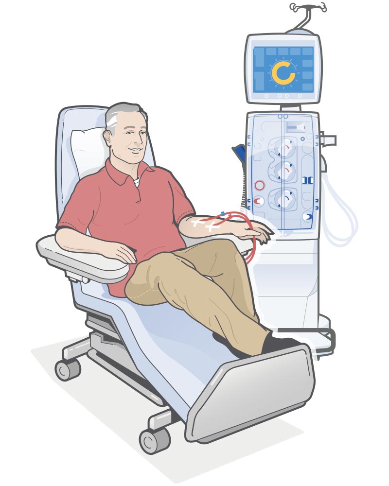 Paciente recebendo tratamento de hemodiálise